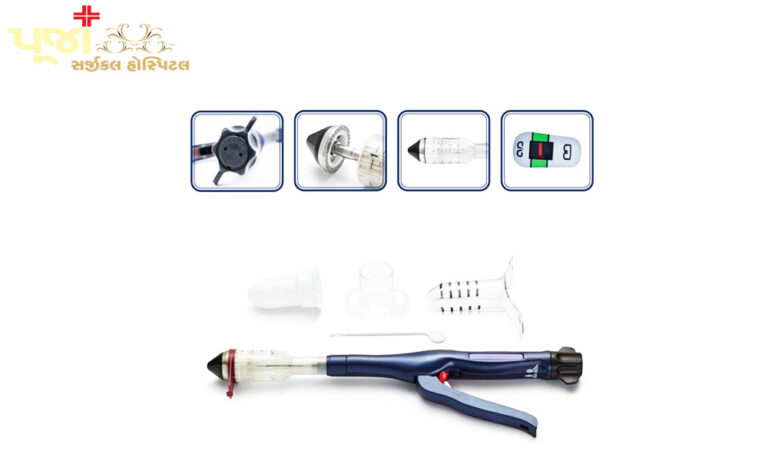 American PPH03 (PPH03 Hemorrhoidal Stapler)